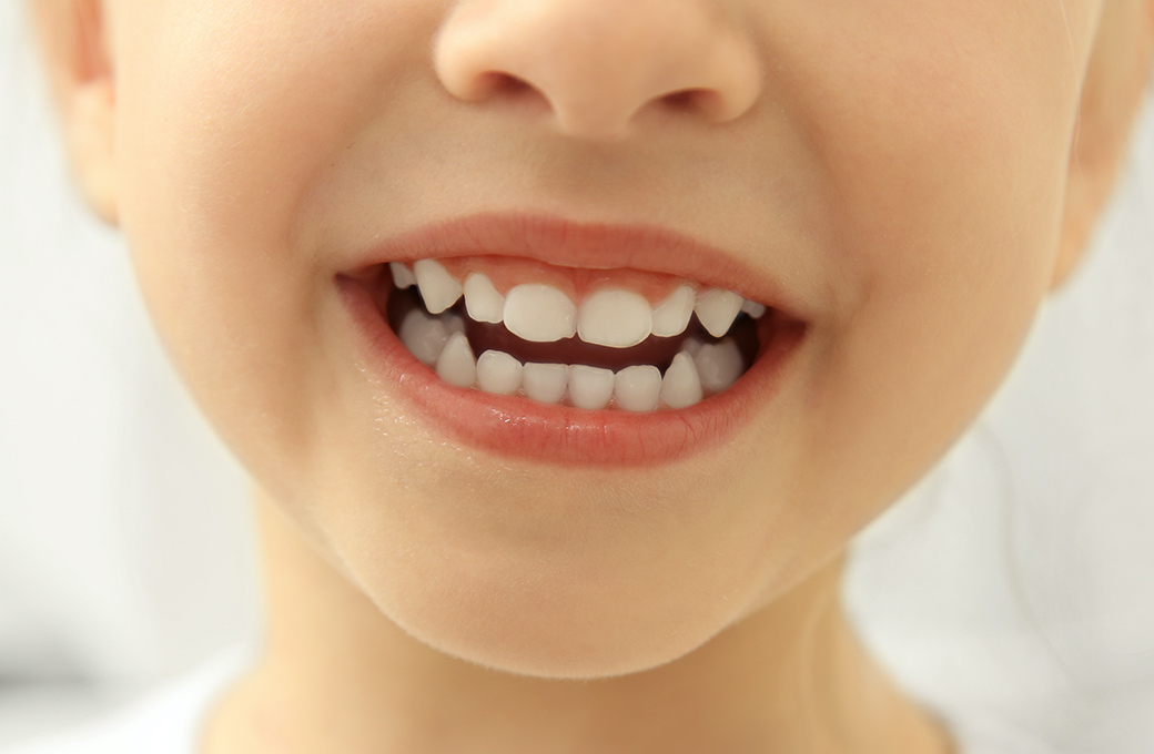 お子さまの歯並びで、こんなお悩みありませんか？